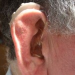 Een gehoorapparaat kan ophopend oorsmeer veroorzaken